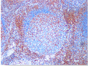 CD3抗体试剂（免疫组织化学）