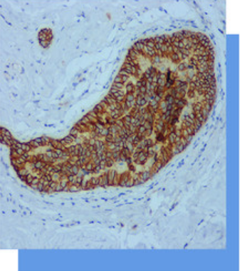 E-Cadherin抗体试剂 免疫组织化学