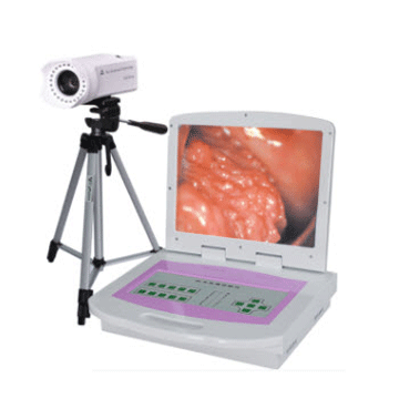 施盟德RCZ-3001型（普通款）数码电子阴道镜
