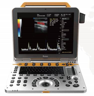大为 全数字彩色多普勒超声诊断仪DW-PF542